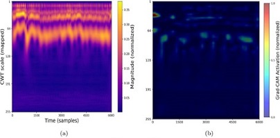 Decoding the Silent Night: Multi-View Deep Learning Revolutionizes Sleep Apnea Detection